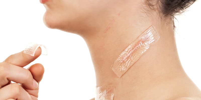 Scar Healing in Winston-Salem, North Carolina