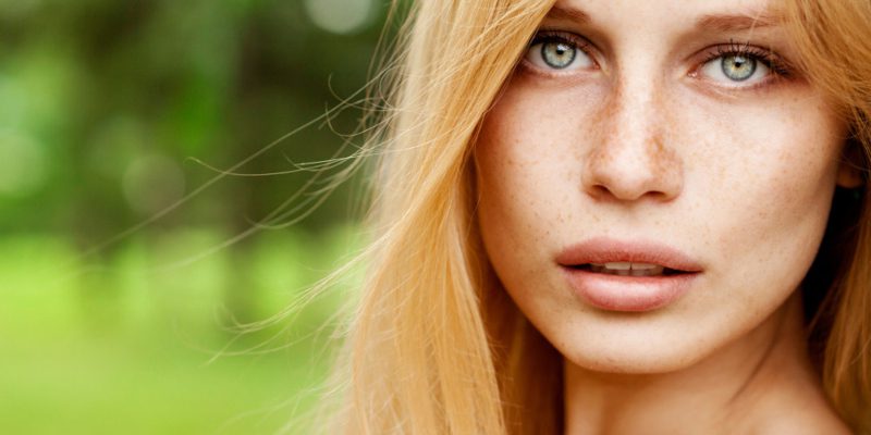 Freckle Removal in Greensboro, North Carolina