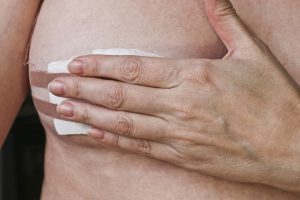 Benefits of Professional Nipple Reconstruction Treatments After Mastectomies