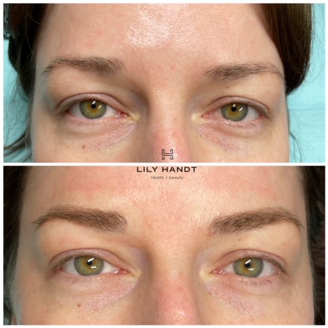 Microblading in Winston-Salem, North Carolina